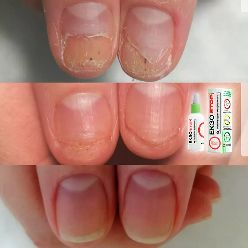 ЕкзоStop відгук 4